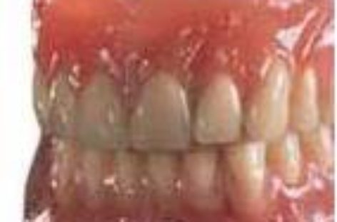 Biofunctional Prosthetic System (BPS)