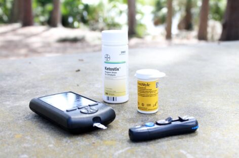 How Diabetes affects the kidneys