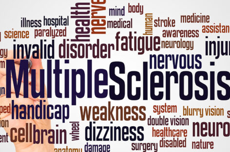 What Is Multiple Sclerosis (MS)?
