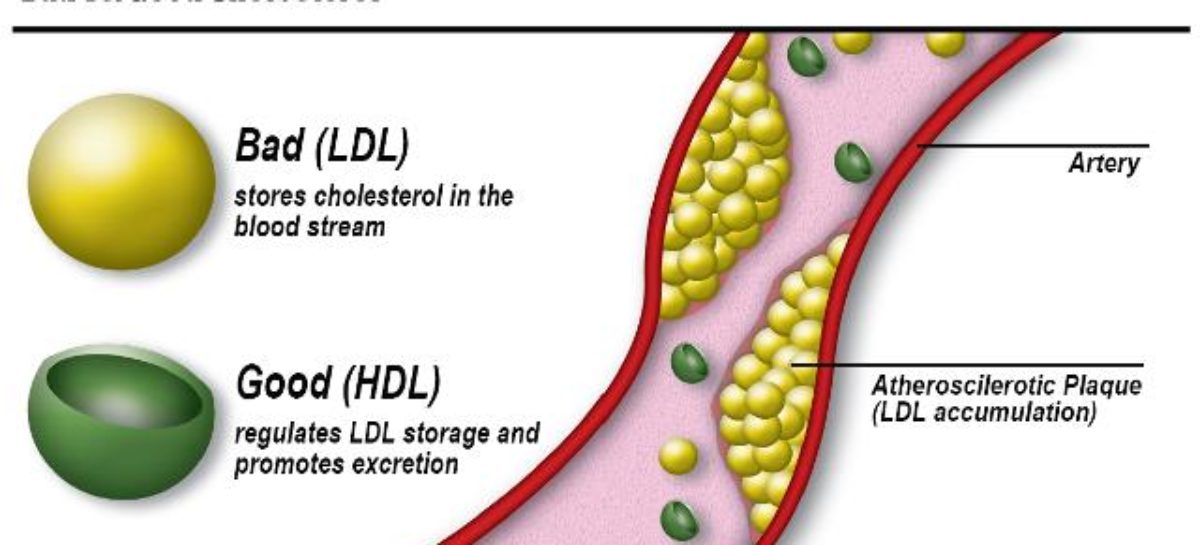 HDL and LDL. Do you know the difference?