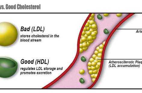 HDL and LDL. Do you know the difference?