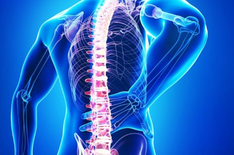 Tips to recover after a Spinal Surgery