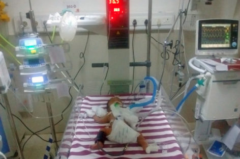 Congenital Heart Disease in Babies and Children