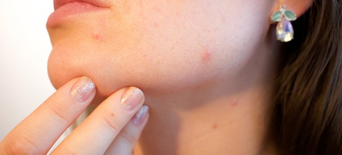 Don’t let your scars define your life