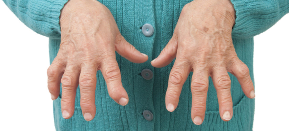 What is Rheumatoid Arthritis?