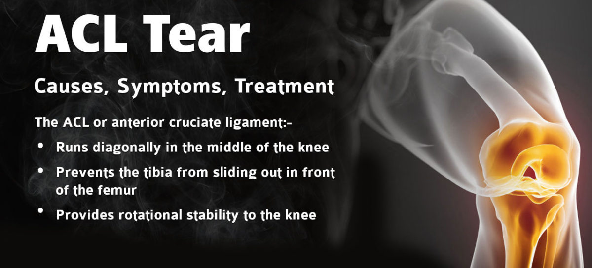 ACL tear – Causes, Symptoms, Treatment