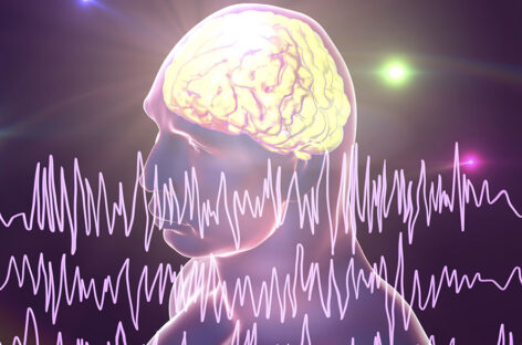 What are the kinds of Epileptic Fits?