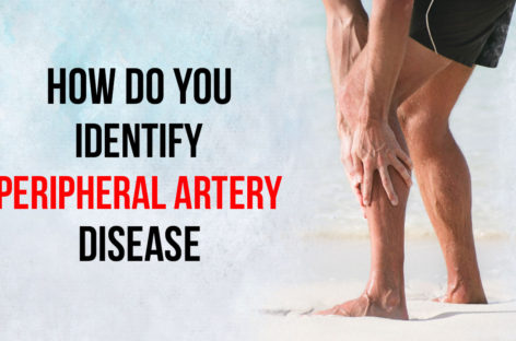 How do you identify Peripheral Artery Disease?