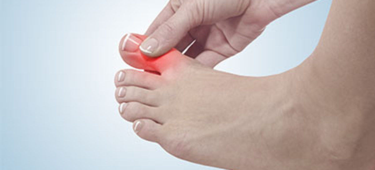 Is an Increase in Uric Acid in the Blood Reason for Alarm?