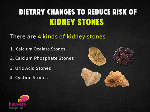 The Diet For Urolithiasis Prevention (Uric Acid Stones) | Download Scientific Diagram