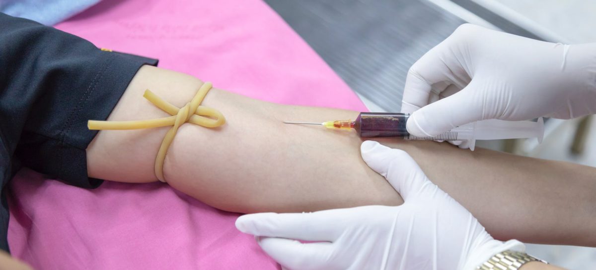 The Importance of Thyroid Blood Tests
