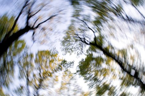 BPVV- Benign Paroxysmal Positional Vertigo