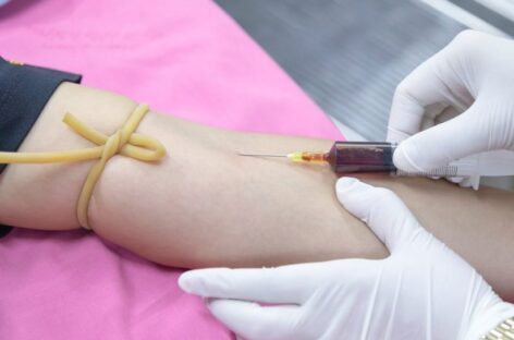 Importance of Regular Heart health Check ups