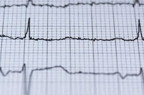 Is it Heartburn or a Heart attack?