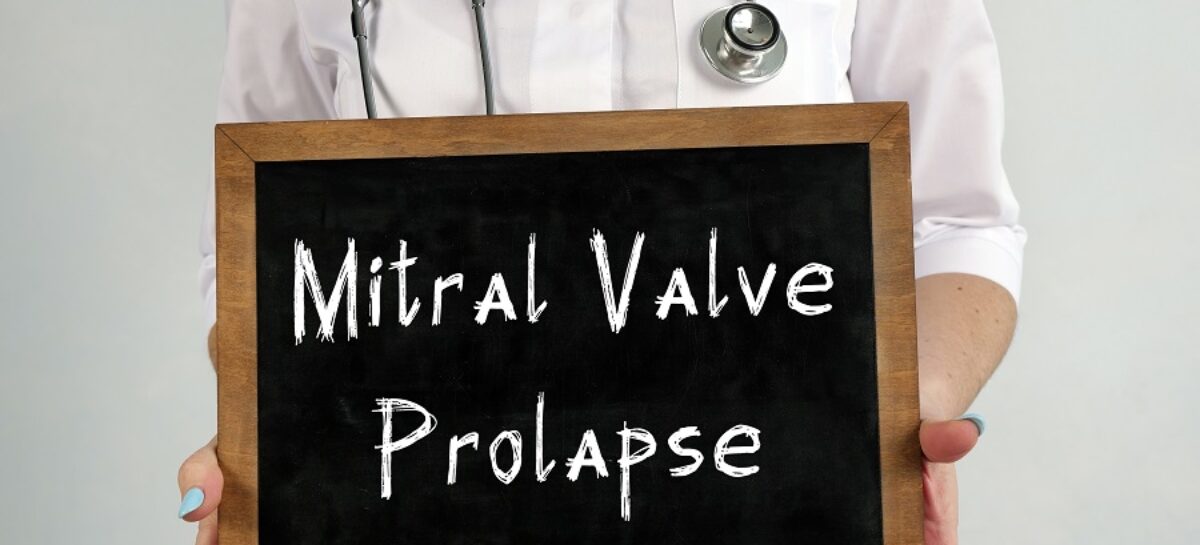 Transcatheter Mitral Valve Replacement