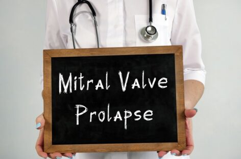 Transcatheter Mitral Valve Replacement