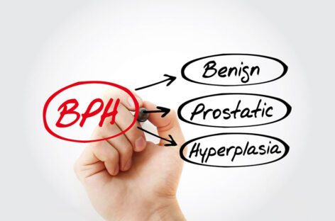 Prostate Enlargement- Symptoms, Risks, Diagnosis and Treatment