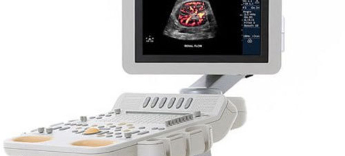 Testing for Abnormal Blood Flow with Doppler Ultrasound