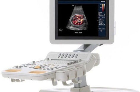 Testing for Abnormal Blood Flow with Doppler Ultrasound