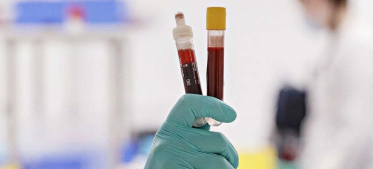 Convalescent Plasma Therapy: A possible cure for Covid-19?