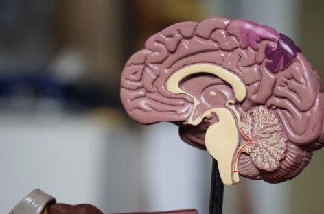 How to deal with Traumatic Brain Injury