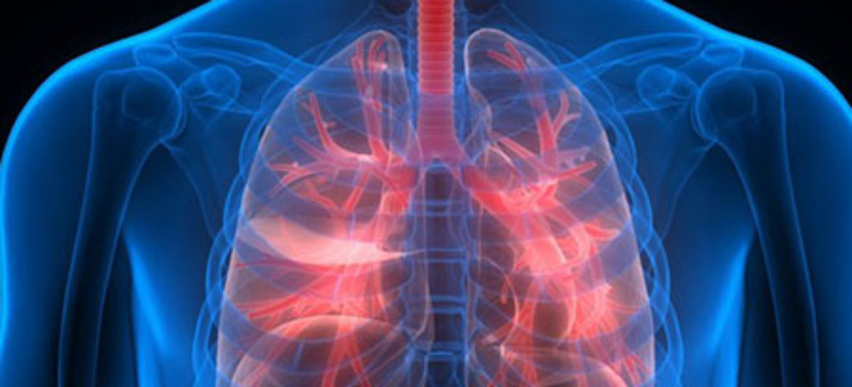 Complications arising out of Respiratory Disease