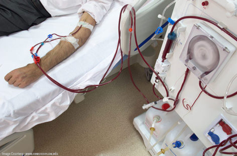 Difference between Hemodialysis and Peritoneal Dialysis