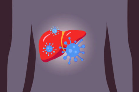 Ways to cope with Hepatitis