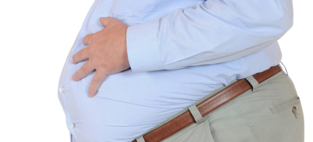 Obesity and Non-alcoholic Fatty Liver Disease