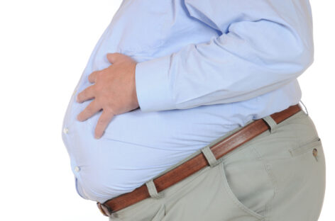 Obesity and Non-alcoholic Fatty Liver Disease