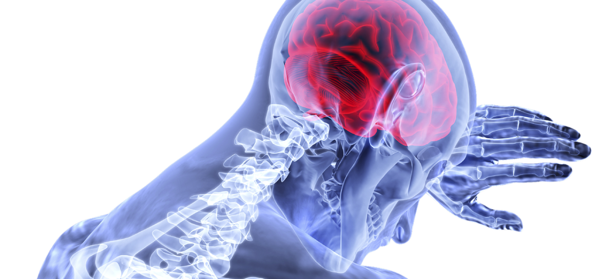 All About Brain Aneurysms