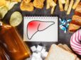 Eight Classic Symptoms of Liver Damage