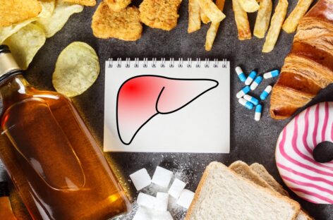 Eight Classic Symptoms of Liver Damage