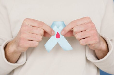 What are the criteria to be a blood donor?