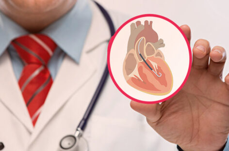 Impella Heart Pump – Necessity and Applications