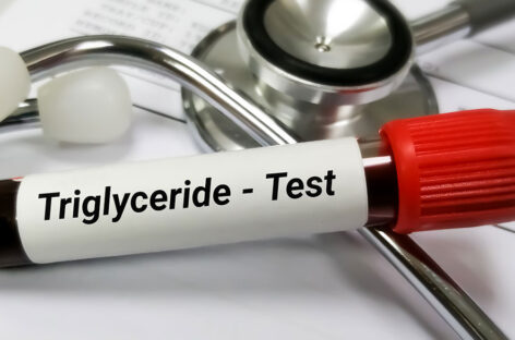 Why should Triglycerides be within normal limits?