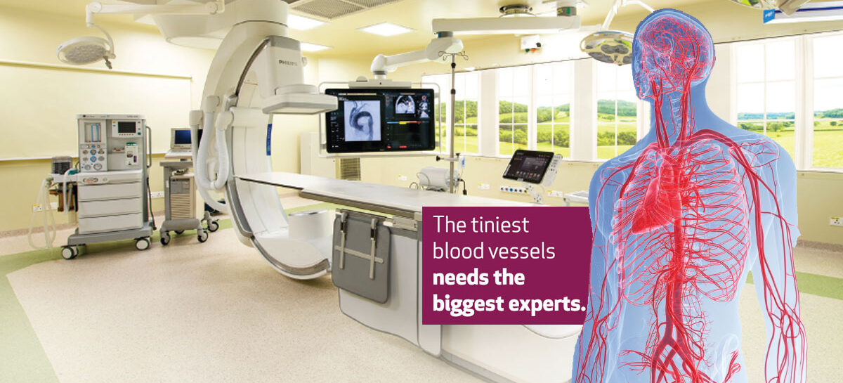 The Tiniest Blood Vessels Needs the Biggest Experts