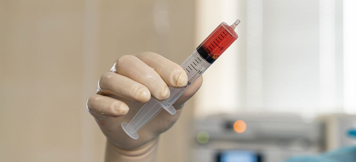 Bone Marrow Transplant:  What you need to know?