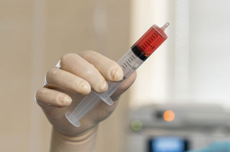 Bone Marrow Transplant:  What you need to know?