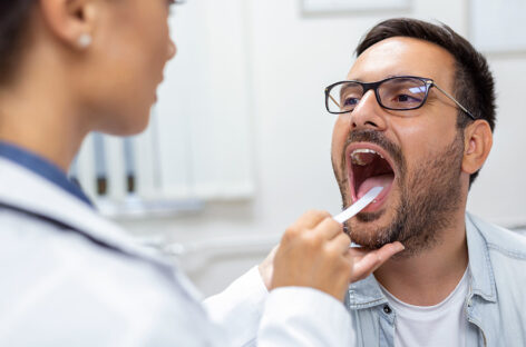 Do you have a white tongue? Know why?
