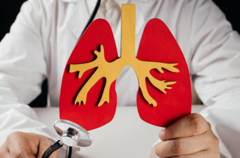 What is Endobronchial Ultrasound Scan and biopsy?