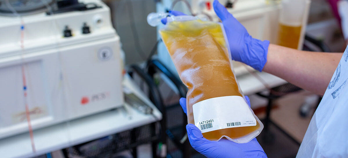 Plasma therapy at Kauvery Hospital Chennai What is plasma therapy, and what diseases are treated by it?