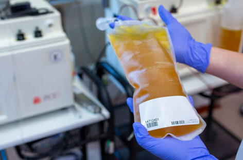 What is plasma therapy, and what diseases are treated by it?