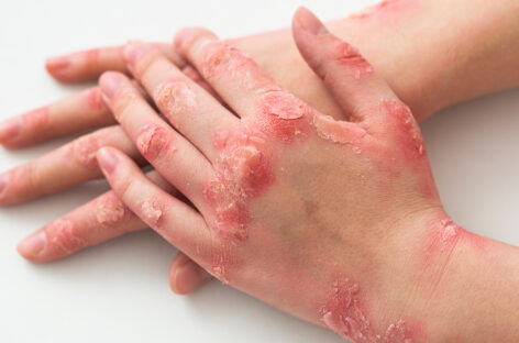 காலங்காலமாகத் தொடர்ந்து வரும் ஒரு நோய்!