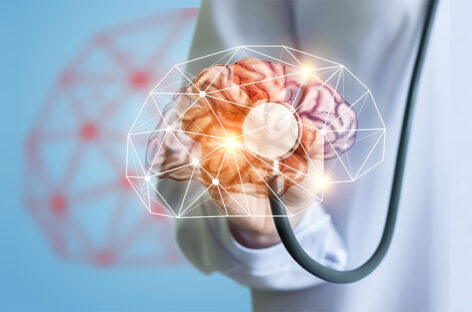 Revolutionizing Neuro Care – The Rise of Interventional Neurology