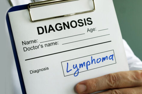 Lymphoma – an overview, types, and genetic risks