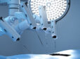 Robotic Surgery in Liver Transplants – Transforming transplantation