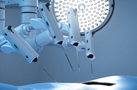 Robotic Surgery in Liver Transplants – Transforming transplantation