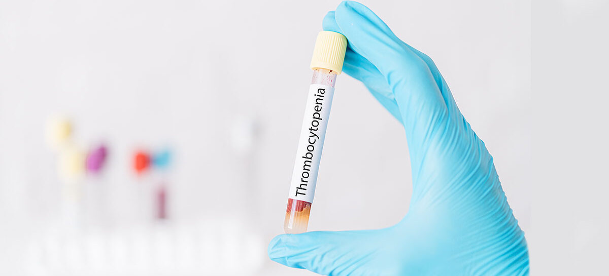 Understanding Thrombocytopenia - Causes, Symptoms, and Treatment Low Platelet Count: Causes, Symptoms and Treatment Options