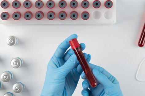 Understanding and Managing Electrolyte Imbalances